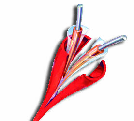 Cable detector tipo XLT